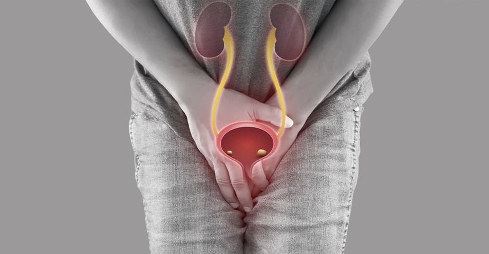 manejo-integral-de-calculos-en-via-urinaria-urologo-certificado-en-cdmx